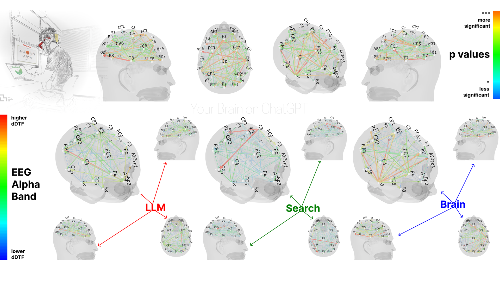 Brain on LLM