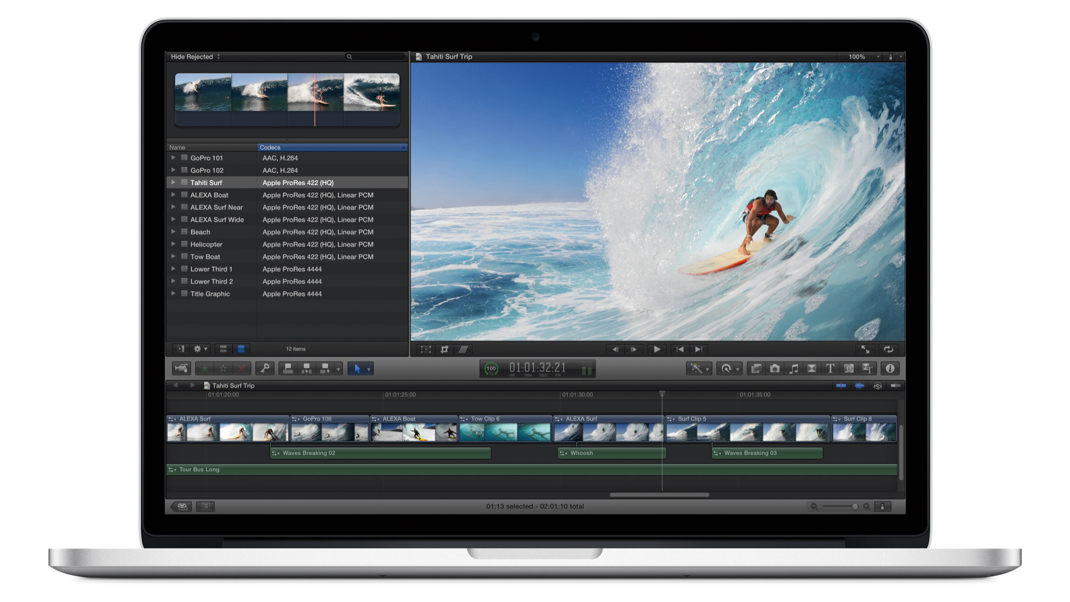 Retina