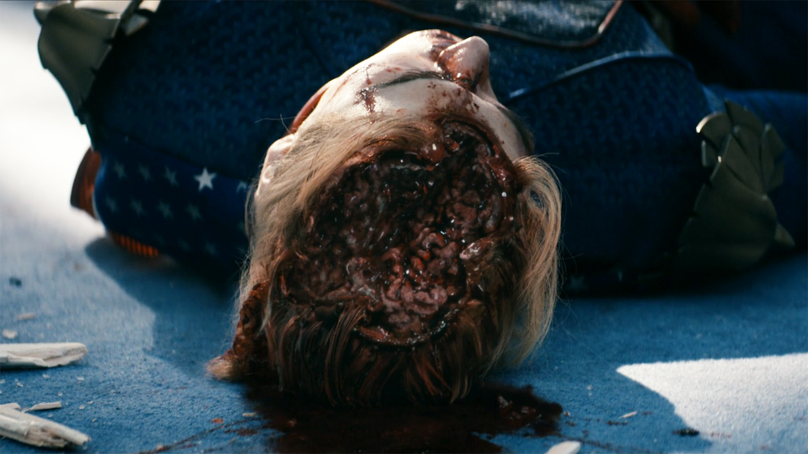 A close up of Homelander's dead body with his brain on display in The Boys series finale